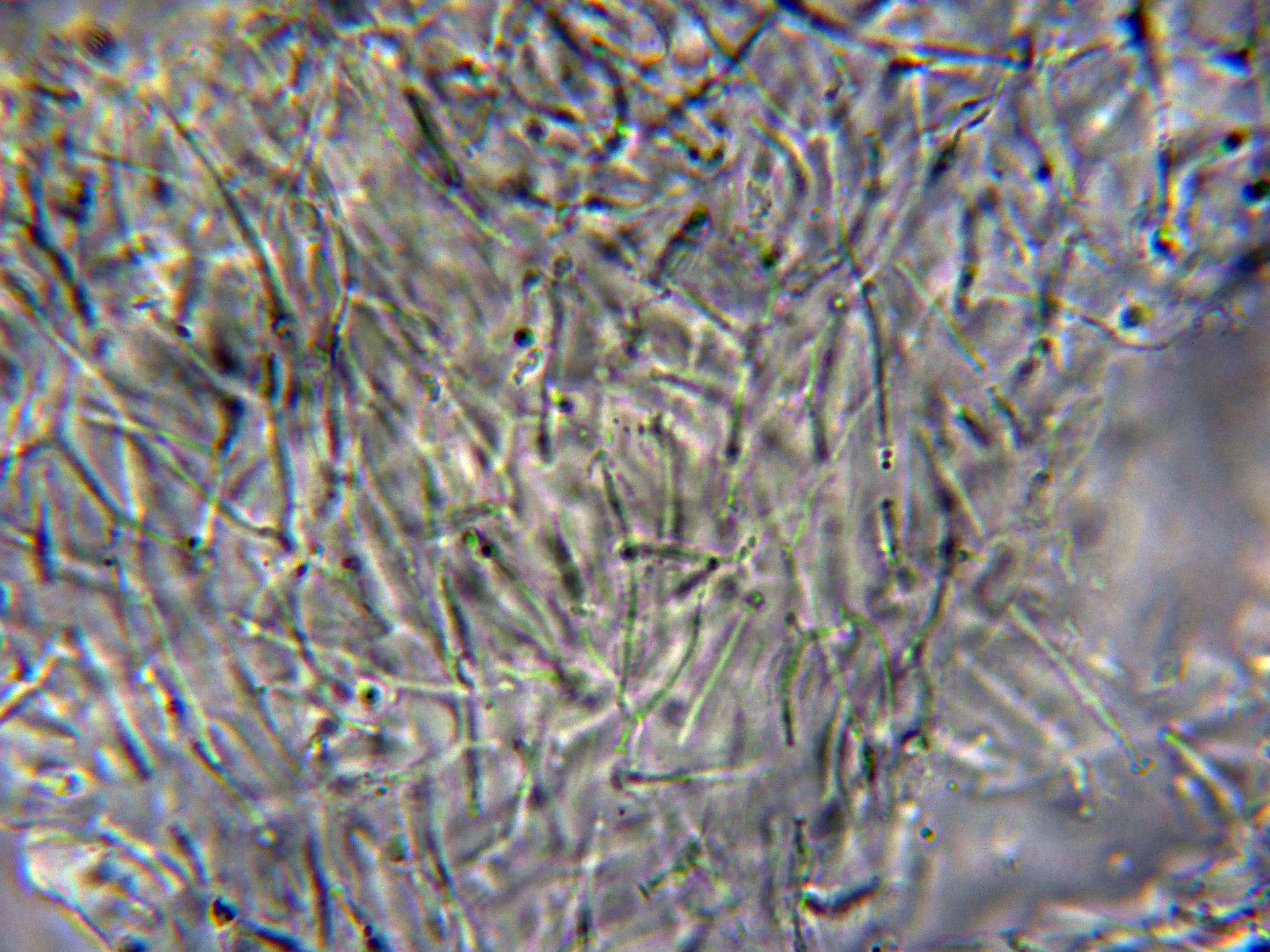 Microscopía de Protoparmeliopsis muralis - 11 - Excípulo KOH-001